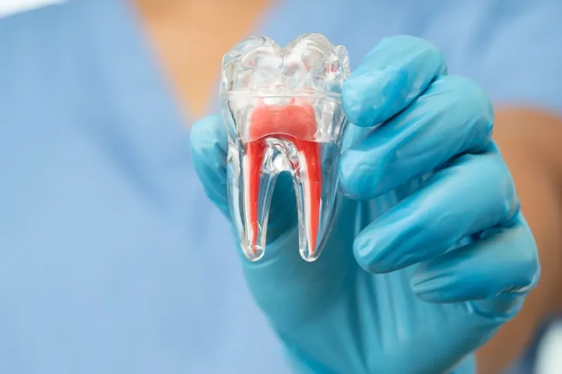 How Much Does a Root Canal Cost in Temple, TX?